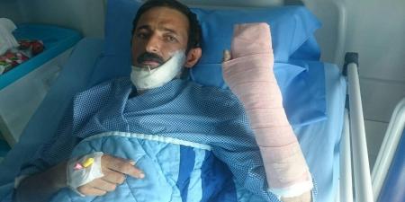پیوند فک ، زبان و دست قطع شده مصدوم 39 ساله+ عکس