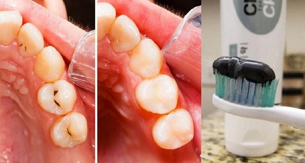 خمیر دندانی که دندانپزشکان را بیکار می‌کند! + عکس