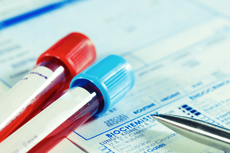 ۲۰ سوال رایج  در مورد آزمایش خون و تفسیر آن