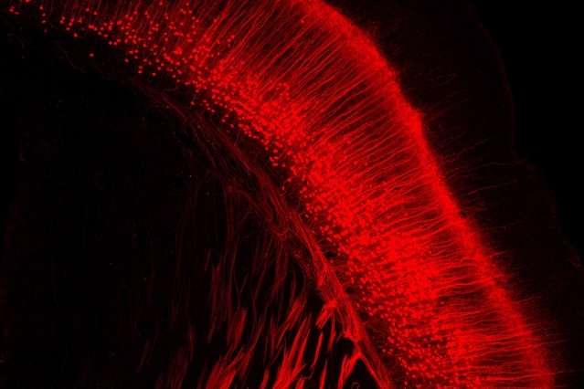 روشی نوین برای مطالعه طولانی مدت سلول های عصبی