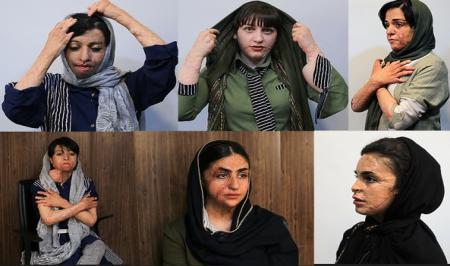 در ایران امکان درمان دانش آموزان شین آبادی وجود دارد 