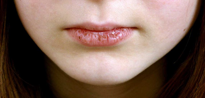 ۵ عامل برای تلخ شدن دهان