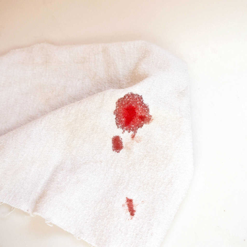 پاک کردن لکه خون بر روی لباس و فرش دستباف