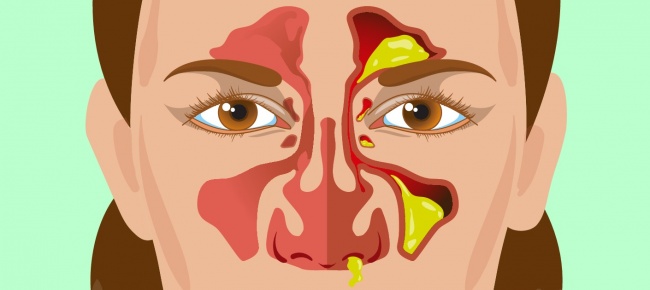 نکاتی که ترشحات بینی درباره سلامت مان می گویند