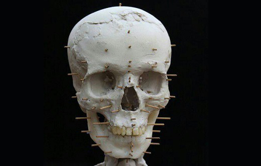 عکس/ مراحل بازسازی چهره از روی جمجمه 9500 ساله
