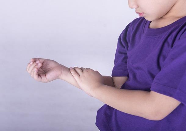 شایع‌ترین شکل ورم مفصلی پایدار در کودکان