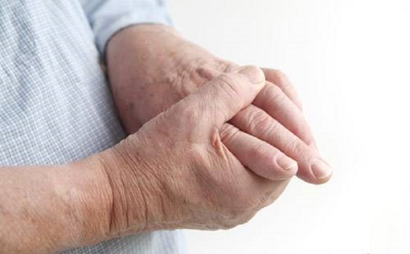  همه چیز درباره نقرس 