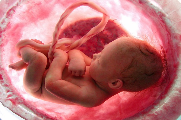 عوامل ایجاد کننده سقط جنین