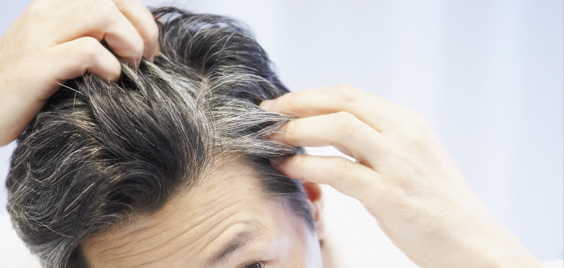 سفید شدن مو نشانه خطر ابتلا به بیماری قلبی