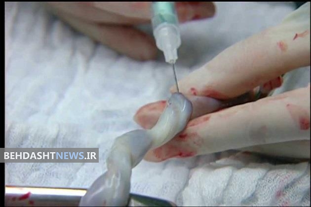  چگونه سلول هایمان را پس انداز کنیم؟ 