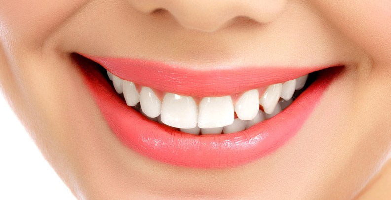دندانهایتان را برای لبخند زیبا تراش ندهید 