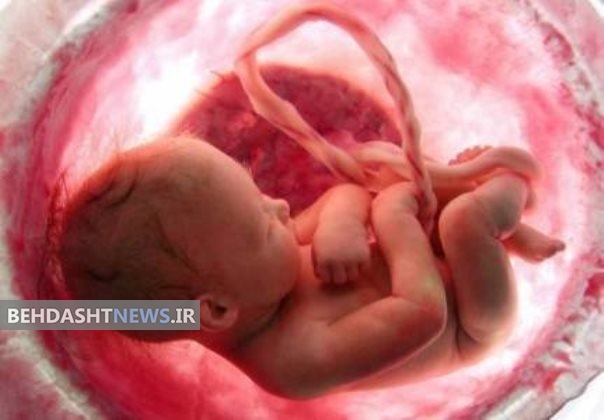 شناسایی و سقط 1350 جنین معلول