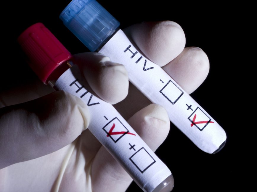  تشخیص سریع ویروس اچ آی وی و هپاتیت در خون با نانوذرات مغناطیسی