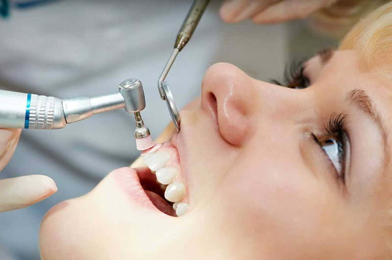 جرم گیری دندان درست یا نادرست؟