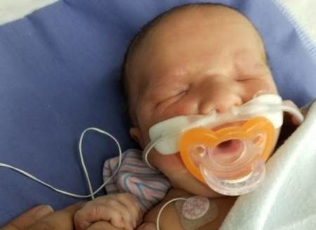  تولد نوزاد بدون چشم همه را شوکه کرد+تصاویر