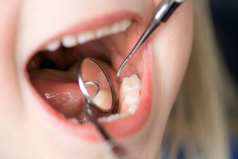 بیماری های دهان با بیماری های بدن چه ارتباطی دارد؟