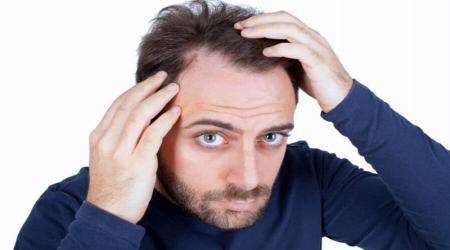 چگونه از ریزش مو جلوگیری کنیم؟