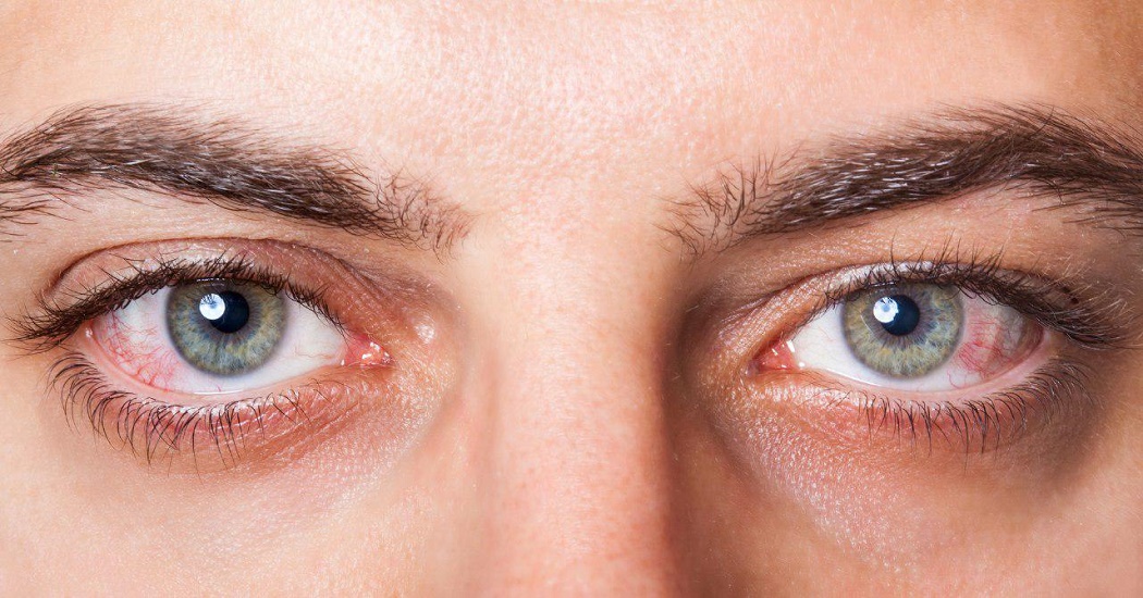  چه ویتامین‌هایی برای خشکی چشم مفید هستند؟