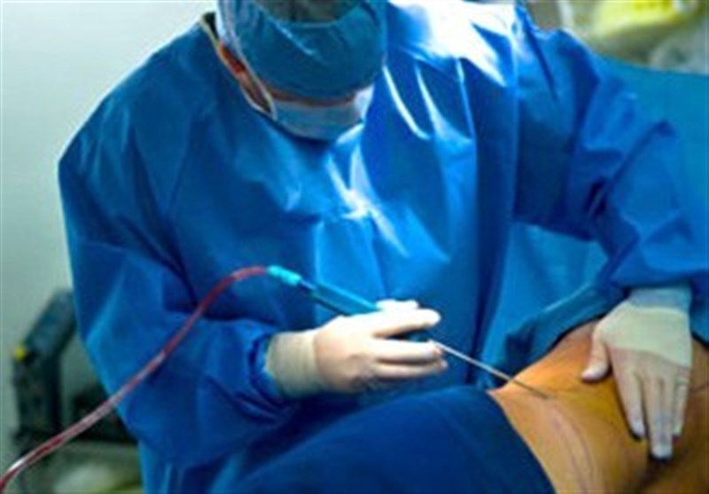 جراحی لیپوساکشن توسط جراحان عمومی ممنوع شد