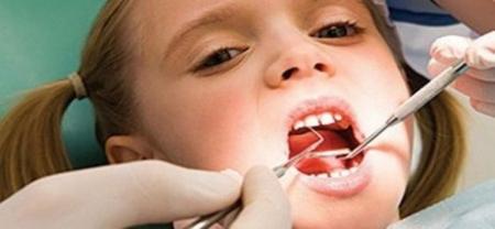  عضو انجمن دندانپزشکان ازوضعیت نامطلوب شاخص سلامت دندان خبر داد