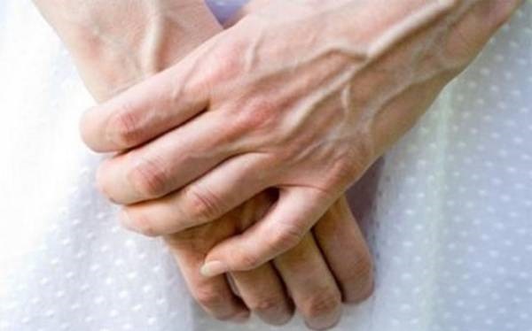 علت بیرون زدگی رگ‌های دست+درمان