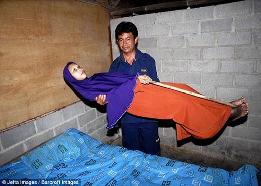 زن جوانی که به چوب خشک تبدیل شد