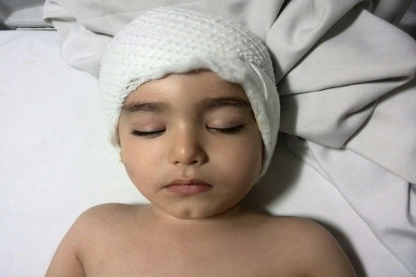 پیگیری حادثه سقوط کودک سه ساله