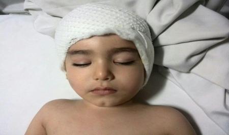پیگیری حادثه سقوط کودک سه ساله