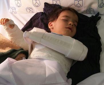  پاسخ دانشگاه علوم پزشکی اصفهان در پی جراحی اشتباه دست کودک 2 ساله