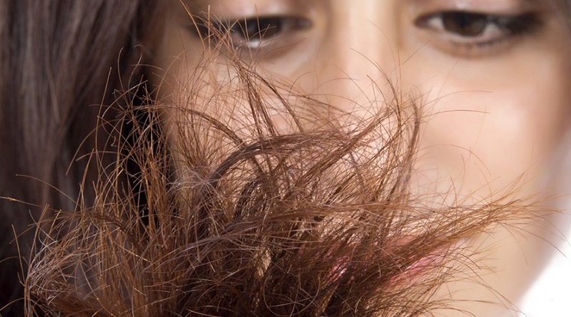  چکار کنیم که موخوره نگیریم؟