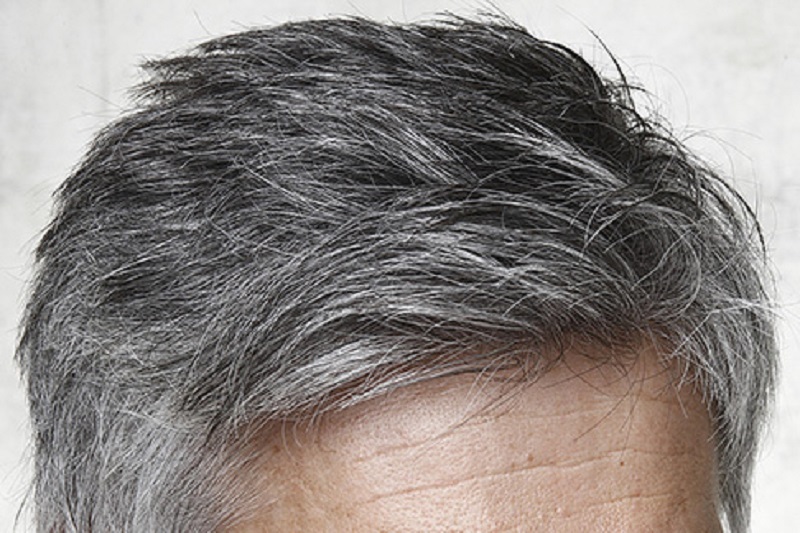 کشف ارتباط موی خاکستری با ابتلا به بیماری‌های خطرناک
