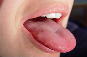 وقتی حس چشایی انسان، سکته می‌کند