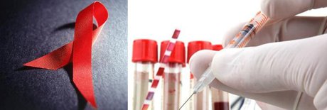 نتایج امیدبخش تست واکسن HIV روی نمونه انسانی