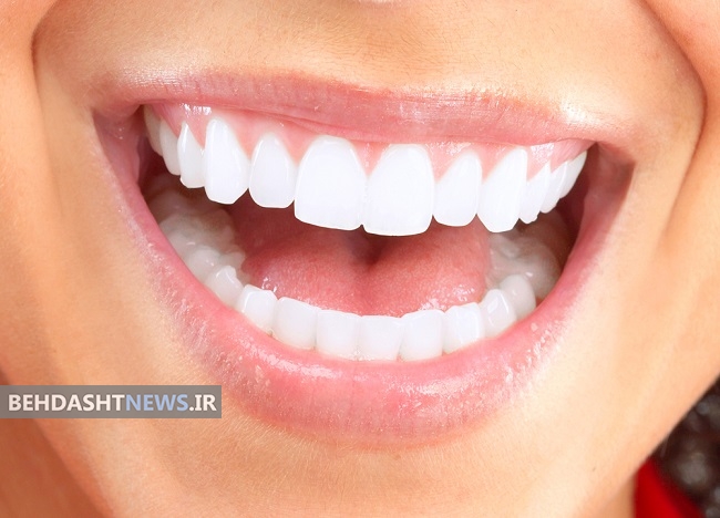 هشت راه ساده برای داشتن دندان هایی سفید و لبخندی زیبا 