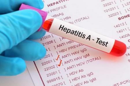  چرا در آزمایش‌های پیش از ازدواج، HIV و هپاتیت لحاظ نمی‌شود؟
