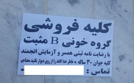  قبل از فروش کلیه این مطلب را بخوانید