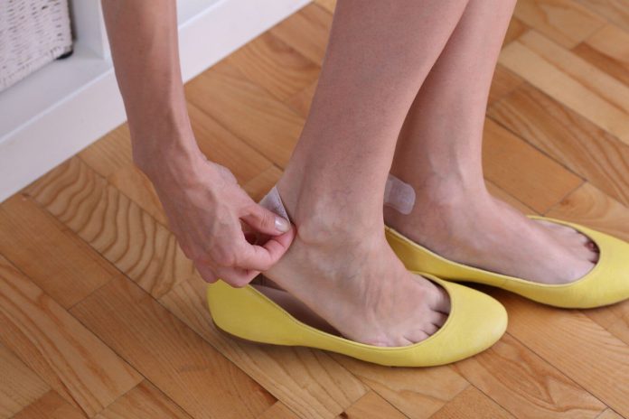 9 روش خانگی برای درمان تاول پا 