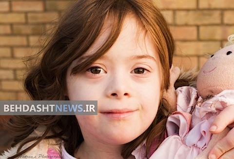 از کجا بفهمم فرزندم مبتلا به سندروم داون است؟