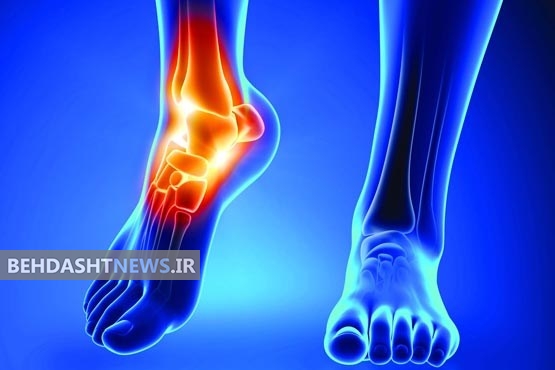  روش‌های طبیعی برای تسکین علائم آرتریت روماتوئید