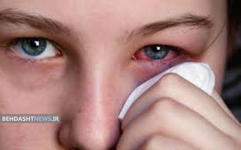 بیماری‌هایی که با مشکلات چشمی خود را نشان می‌دهند 