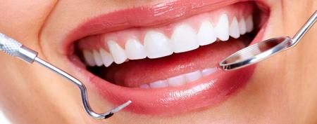  فواید ایمپلنت نسبت به بریج چیست؟