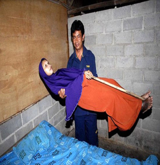 زَنی که تبدیل به چوب خشک شده است + عکس