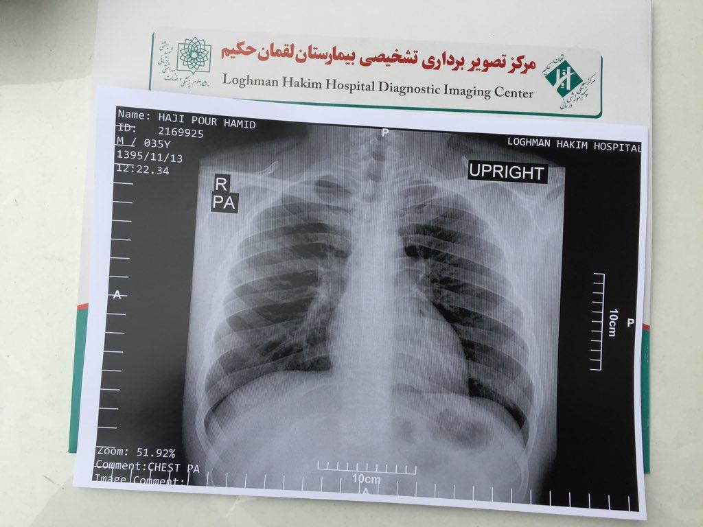 در حادثه پلاسکو درخواست ماسک کردیم، ندادند! +عکس