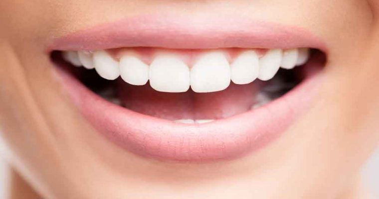  بهترین سفید کننده خانگی برای دندان چیست؟ 