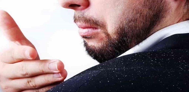  برای رهایی از شوره سر، سمت این مواد غذایی نروید
