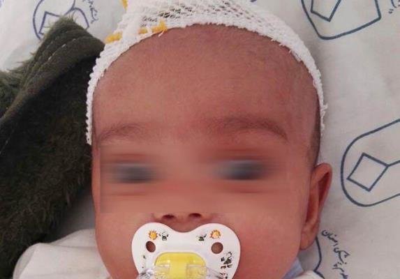 کودک آزاری منجر به ضربه مغزی کودک سه ماهه شد