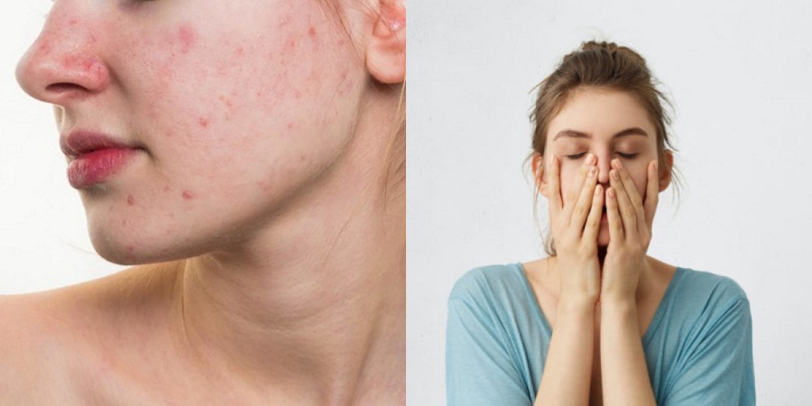 اضطراب دقیقا چه بلایی سر پوست می آورد؟