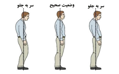 آشنایی با ورزش های اصلاحی