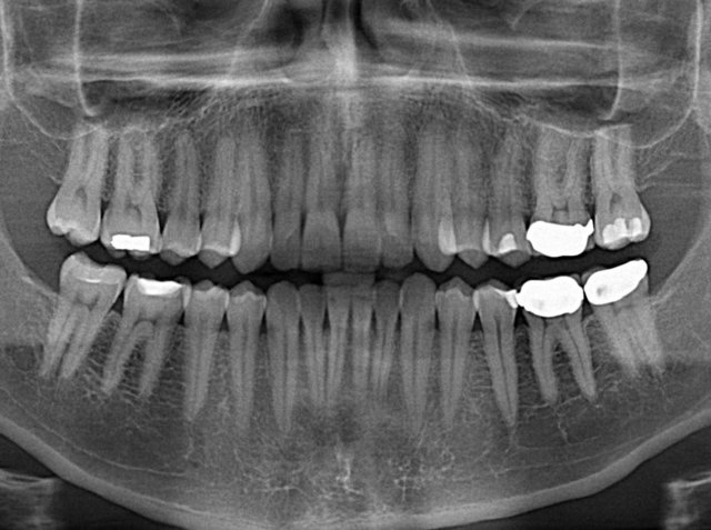 مشکل خدمات دندانپزشکی در شهرهای بزرگ