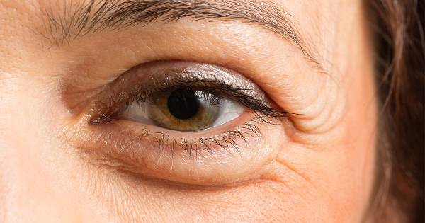 این قسمت از صورتتان چین و چروک دیدید باید نگران شوید+عکس